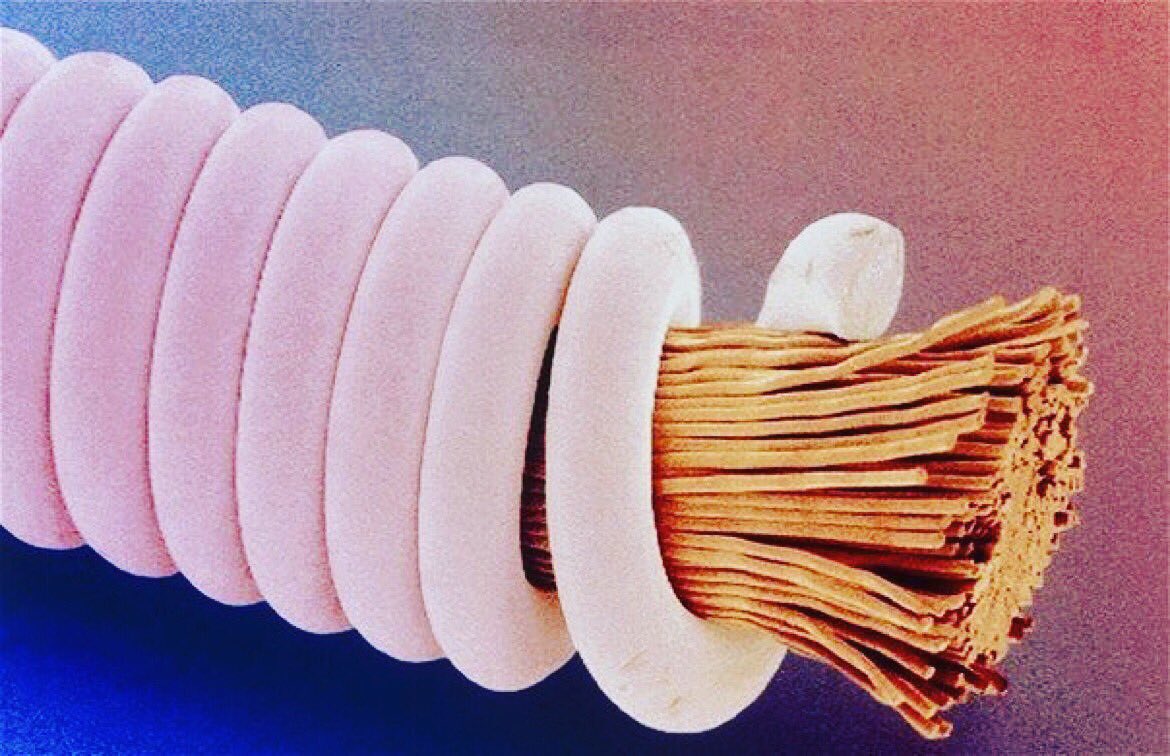 Trying to guess what this is? It's a microscopic image of a guitar string. #guitar #music #monday #microscope #smallworld