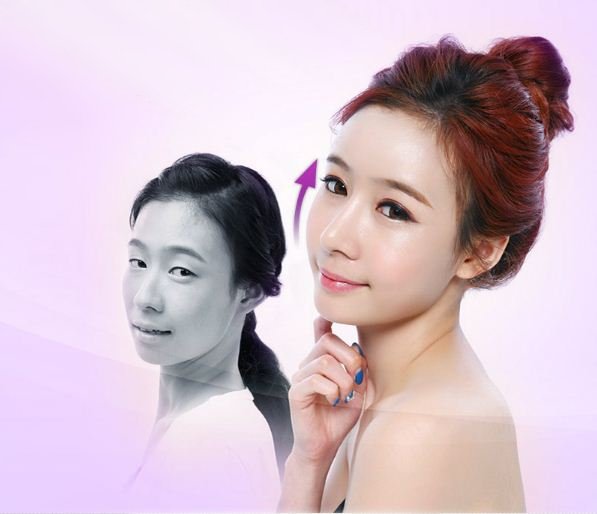 synergypsc's tweet photo. #cheekbone_surgery 
Undertake the Professional’s Word &amp; Obtain A Personalized Look!
https://t.co/hyYgJxUDS7 https://t.co/RctQpi3KUW
