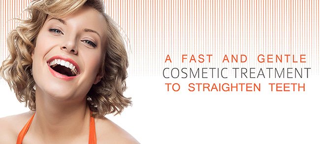 Ingramsdp's tweet photo. Why not start spring off in style with @cfastortho - a fast way to get the smile youve always wanted! #shorttermortho #lingualbrackets https://t.co/PZBybWg4Al