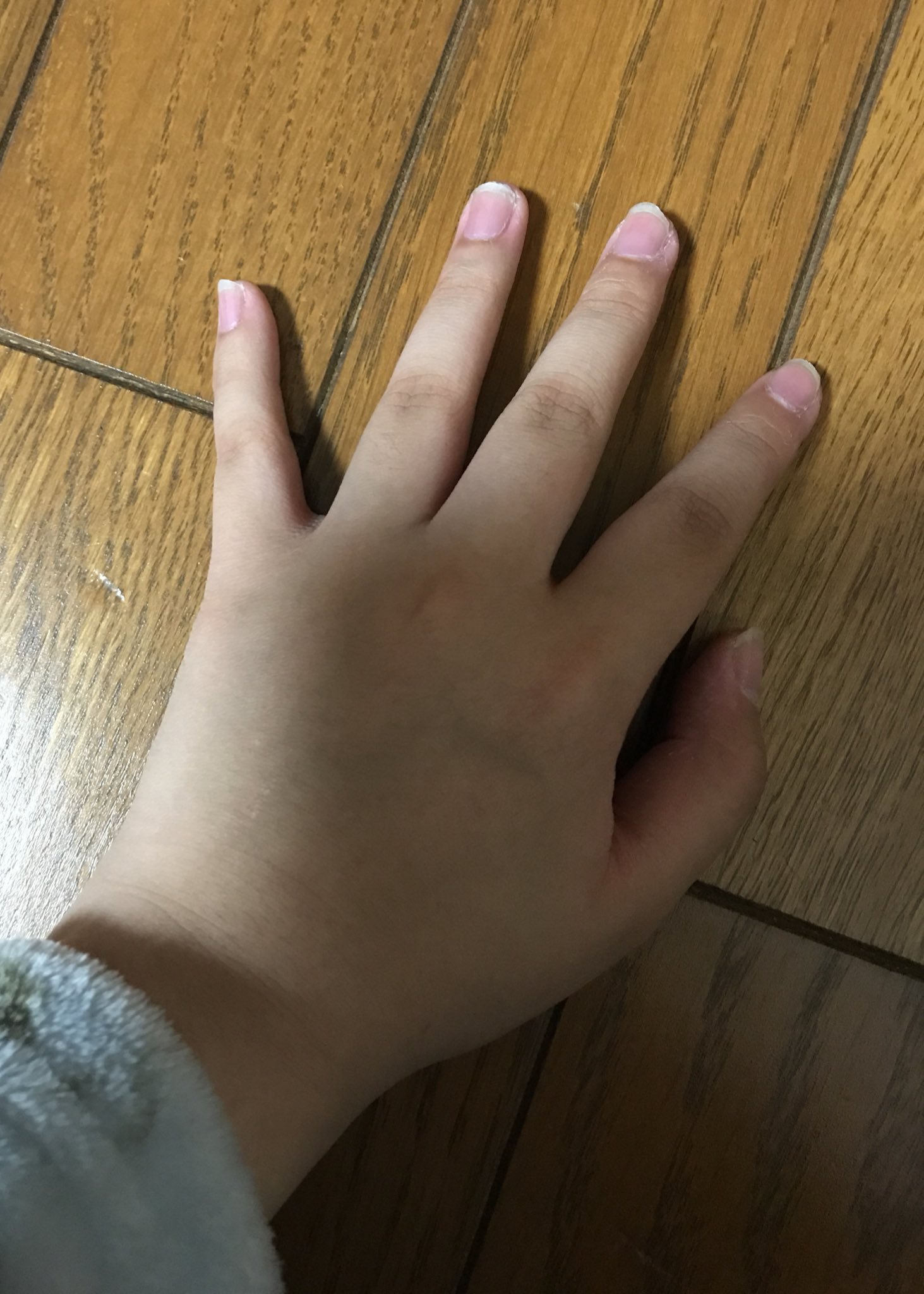 はなうさぎ Twitter પર 手を晒して女と思ったらrt男と思ったらいいね 私の手むちむちしてるし 指短いしスラってしてないのやだ そして 私さかむけ剥いちゃう癖とか爪噛む癖とかあるから余計汚いの はぁ 小さい頃からの癖って本当に抜けない 最近は我慢し