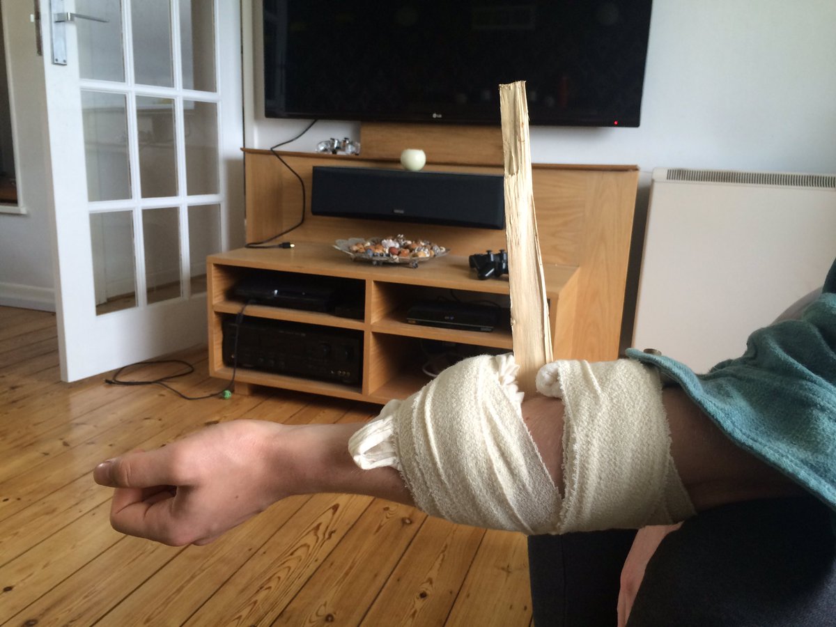 Now that's a protruding wound! #firstaid #lifeguard <a href="/NickThornSurf/">Nick Thorn Surf</a> #surfersworld