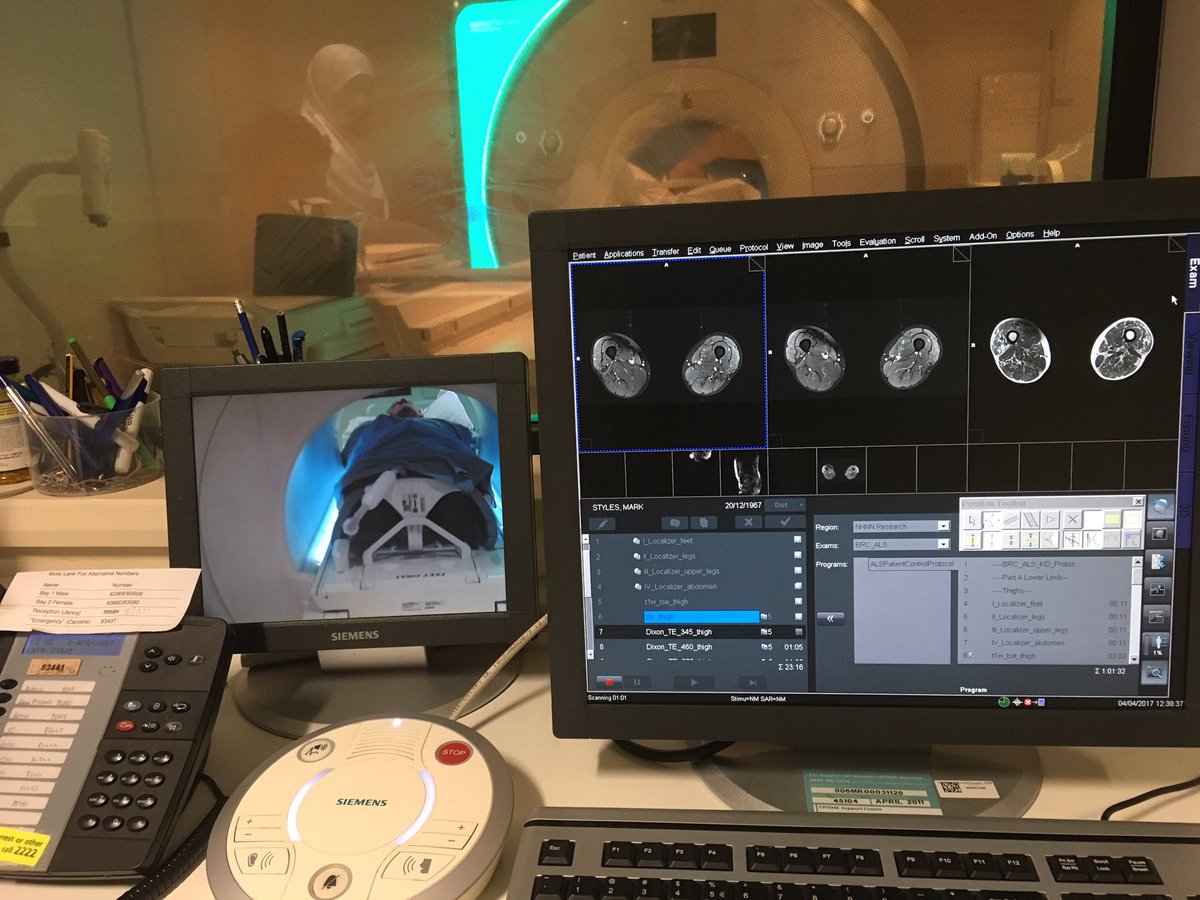 MRI scans will be used to look at my muscles 💪 over time &amp; see how they change. Thank you <a href="/uclh/">UCLH</a> staff for allowing this photo #mindblowing