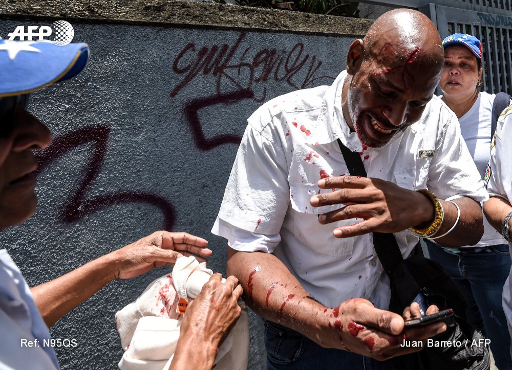 AFPespanol's tweet photo. #ULTIMAHORA Nueve heridos, uno de bala, en protesta de la oposición venezolana (alcalde) #AFP https://t.co/Vp83Iifq7t