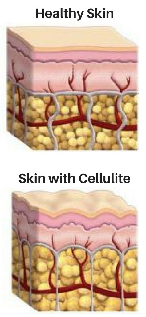 Deep Tissue #Massage Impacts Body Dimensions conta.cc/2oWsYSa