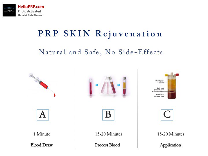 helloprp's tweet image. Hello PRP Therapy
#plateletrichplasma
Service@HelloPRP.com