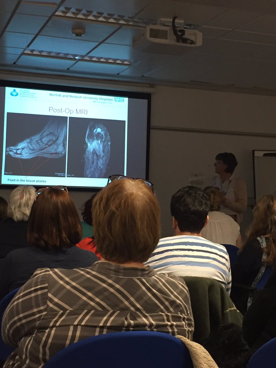 DiabetesUKMidsE's tweet photo. Full house at @DiabetesUK and @NNUH putting feet first event #sharing knowledge #reducingamputations #earlyreferraliskey https://t.co/EpRO0YdFzR