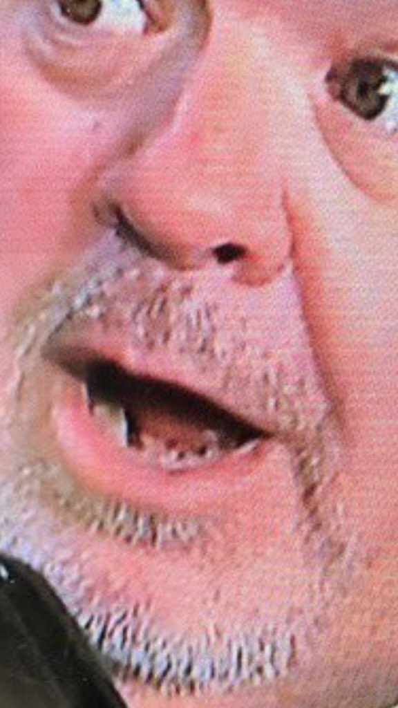 youvebeenmushed's tweet photo. @nick_kokoliadis @Jared_Carrabis WTF is up with that grill ?! #Eeeeww https://t.co/VsIXikzZY1