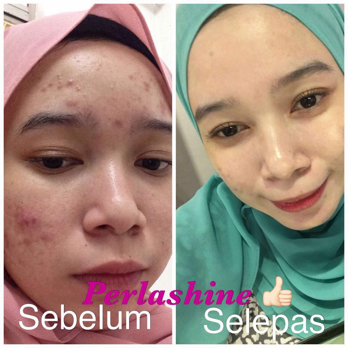 OfficialAmoy's tweet photo. DSI Perlashine
RM125 (EXCL POSTAGE)
Whatsapp/ Telegram 60128654960
#agent #sabah #malaysia #april #sayajual #baazarpaknil #perlashine #dsi https://t.co/Bys8vRuECx