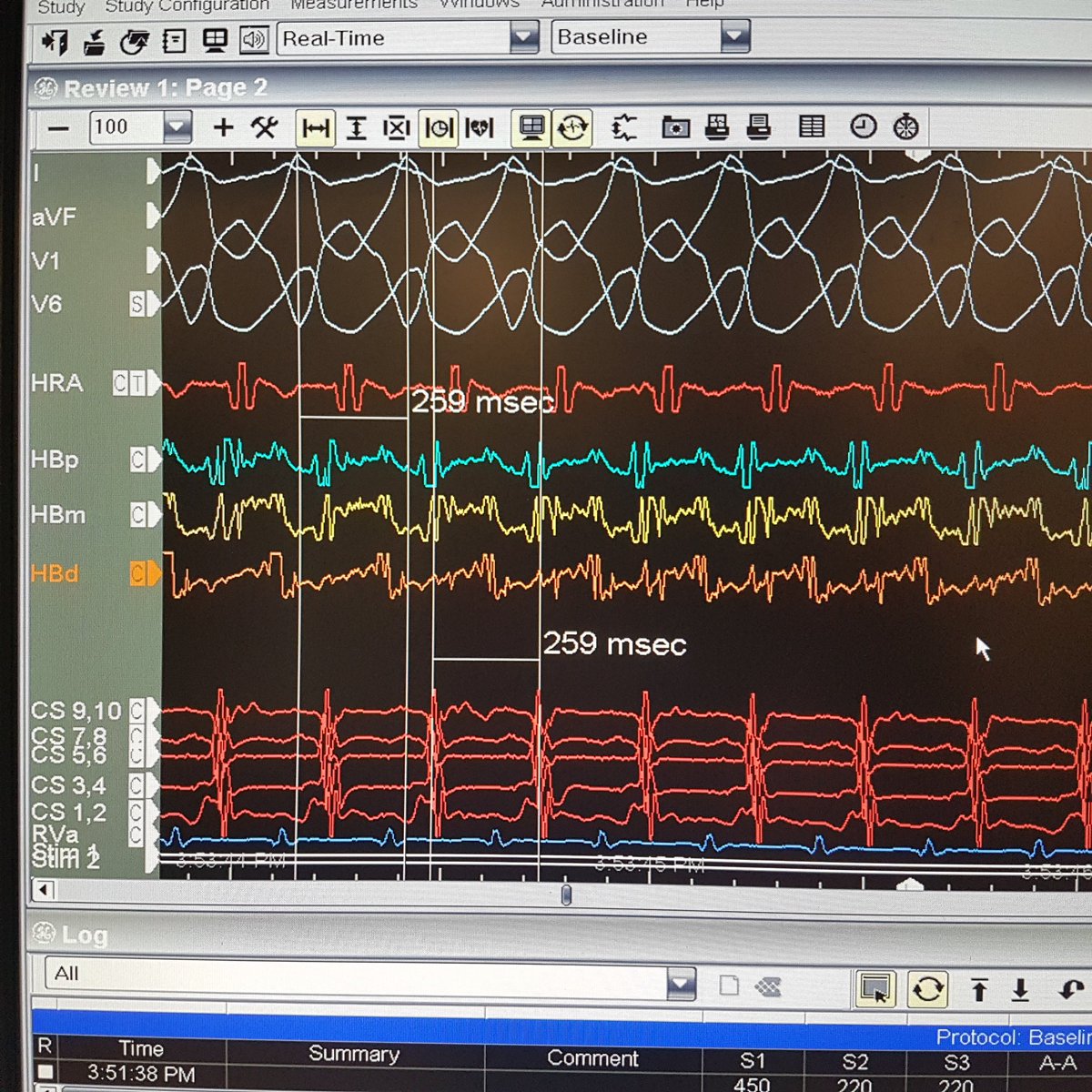SchakrabartiEP's tweet image. CS 910 @ CS os. HRA =RAA.