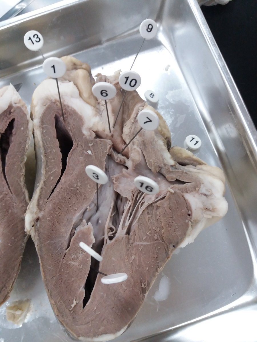 taylorjordan563's tweet photo. Sorry for the graphic pictures but this was so cool amd interesting to me. #sheepheart 🐑💔 https://t.co/HFzTrBjEl2