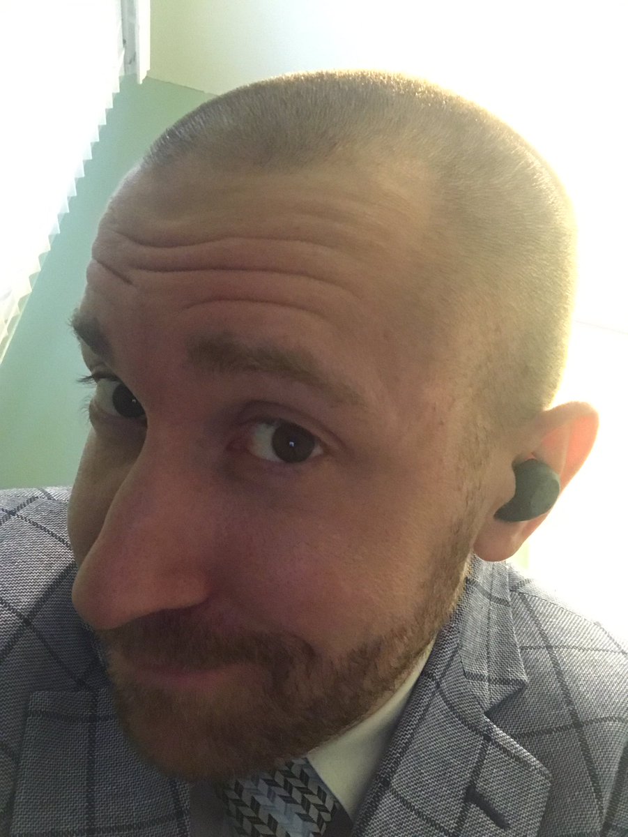 CallMeCanary's tweet image. On Sunday I shaved my head for @StBaldricks and helped raise nearly $500k for cancer research.  #baldbychoice and proud :)