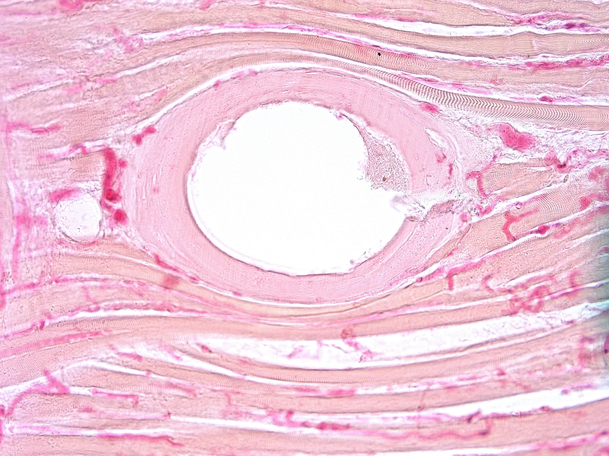 человеческая трихинелла. трихинелла спиралис в мышцах. паразит обитающий в мышцах. паразитические круглые черви трихинелла. трихинелла спиралис капсула.