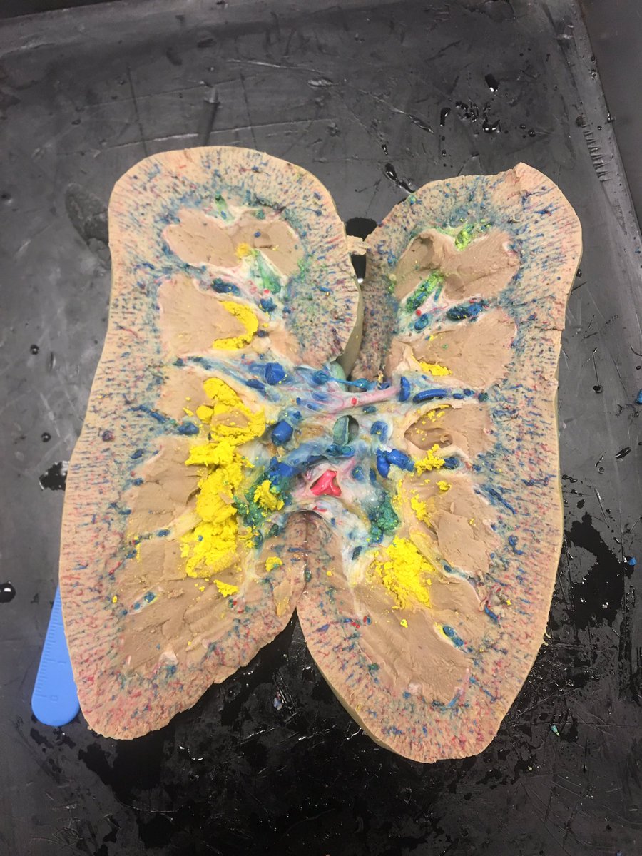 Today students preformed a dissection on pig kidneys in order to gain better understanding of its anatomy!