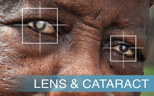 EyeVue1's tweet photo. Patient Education in Laser Vision Correction https://t.co/hOguZf8Du1 https://t.co/ttonhH0l1H