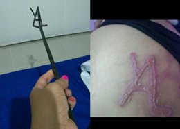 leidyrios19's tweet photo. Indignación en Neiva por caso de mujer "marcada" como ganado.
https://t.co/z5cAuDr50k
#PeriodismoVirtual https://t.co/2dT6EMUjhJ