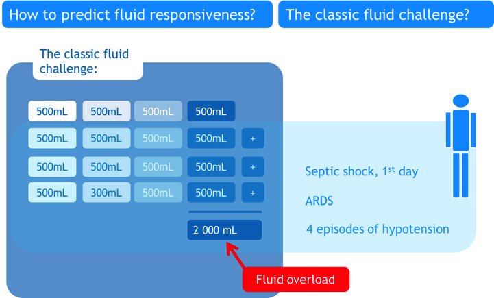 Manu Malbrain (@manu_malbrain) on Twitter photo Fluid challenges up to the point when patient is no longer responsive = WRONG <a href="/prxamonnet/">Xavier Monnet</a> <a href="/Fluid_Academy/">Fluid Academy</a> #ECCC Fluid challenges up to the point when patient is no longer responsive = WRONG <a href="/prxamonnet/">Xavier Monnet</a> <a href="/Fluid_Academy/">Fluid Academy</a> #ECCC