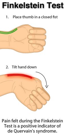 what test de quervain