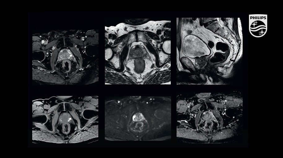 PhilipsHealth's tweet photo. Check out a comprehensive #MRI exam of #prostate for #RadiationTherapy https://t.co/287re7jgAo
#RTplanning #oncology https://t.co/A3OERzIBmu