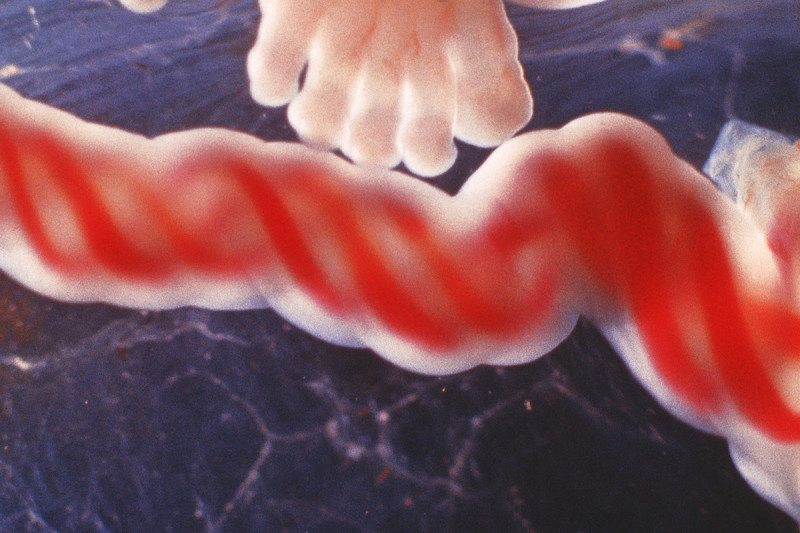 jackverr54's tweet photo. #plasma #TIMP2 #where #are #we #going?
Blood from human babies makes brains of elderly mice young again https://t.co/IMcTABzkpz https://t.co/TxeCI3u0TR
