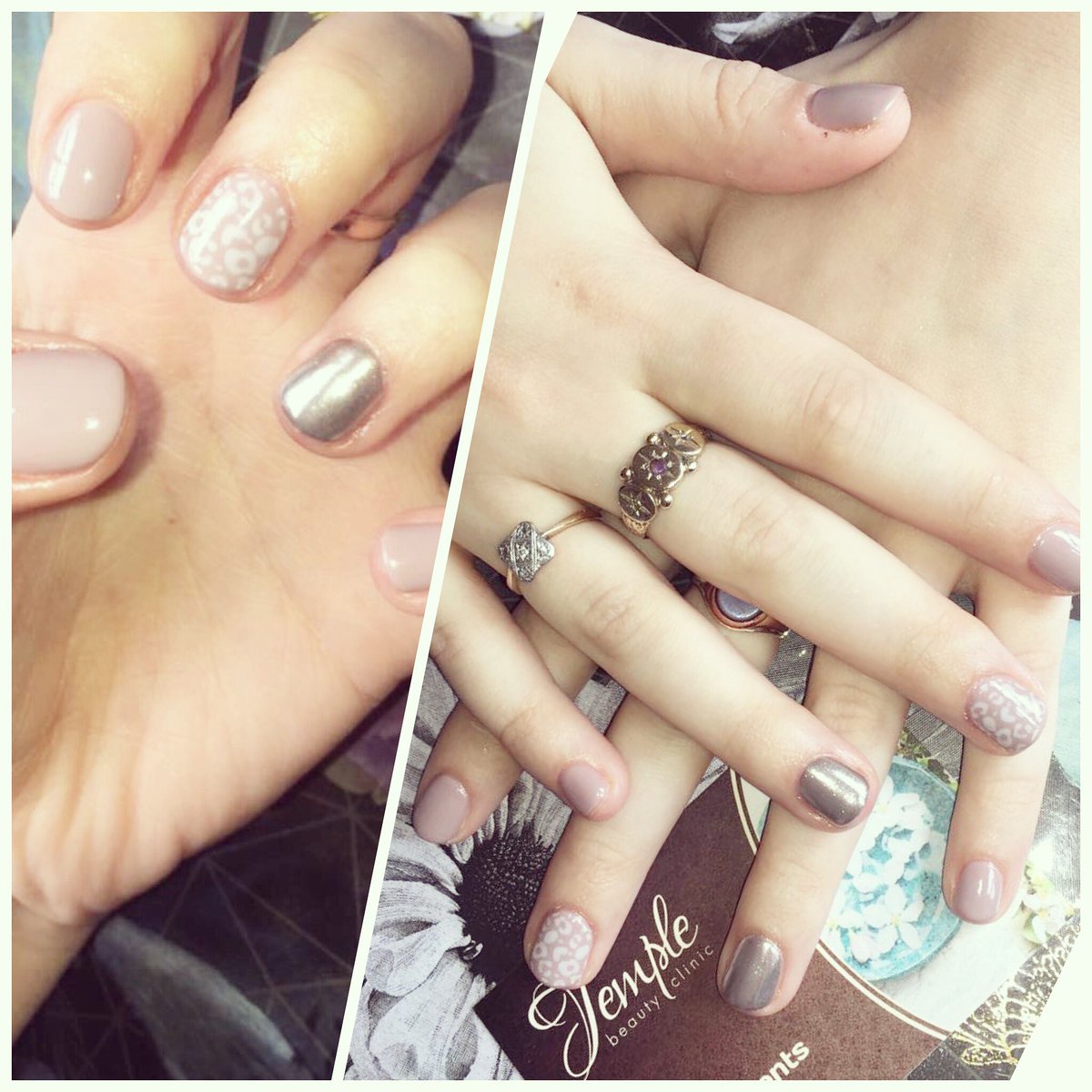TempleClinic's tweet photo. Loving these @CNDWorld #shellac nails in #fieldfox with @lovelecente #silverchrome and stamp using #creampuff done this morning by Rebecca https://t.co/8KwqZ1kTY9