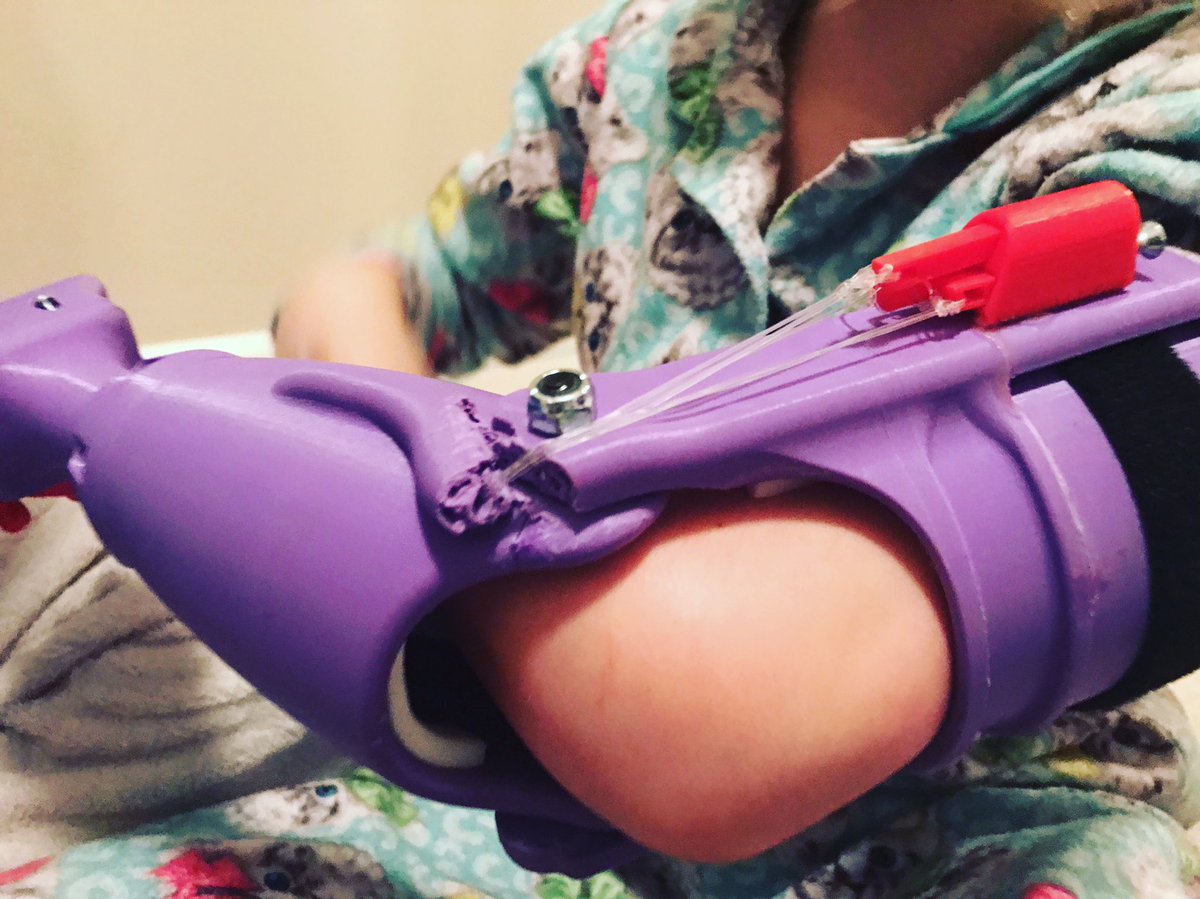 form5prosthetic's tweet photo. Maddie's test Arm; These photos provided detail on modifications needed to be made for her final Panda Arm! #Forming5 #Maddie #3DPrinting https://t.co/NBfqNeRuMD
