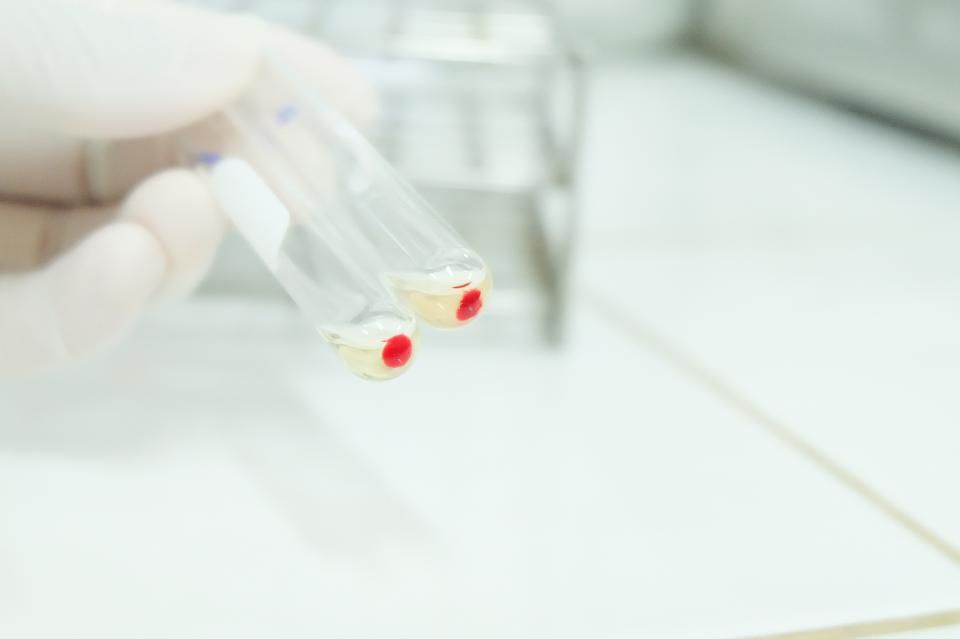 in1touch's tweet photo. Google Offshoot Starts A 10,000-Person Study To Plumb Human Biology https://t.co/WuRkqx5aWT - #humans #verily #blueprintstudy - @Forbes https://t.co/ajjRW9i1OU