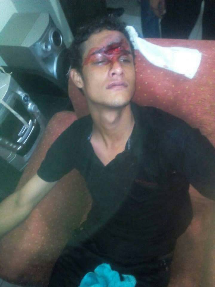 AndrewsAbreu's tweet photo. #AHORA 10:00pm En los Araguaney, San Joaquín el joven herido por bomba lacrimogena que impacto en su cara ya trasladado a hosp. | Cortesía https://t.co/rQ6YbZBCWB