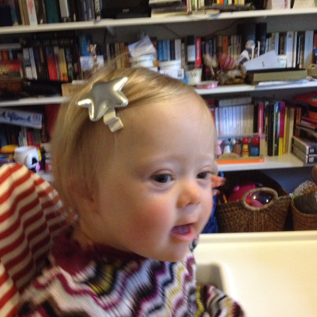 AnimalsinWire's tweet photo. 1yr old A is loving her new star clips! By fellow E17 maker @OttiandLiv. From the great @MothersHubE17. Bx https://t.co/z6imkTAlxV