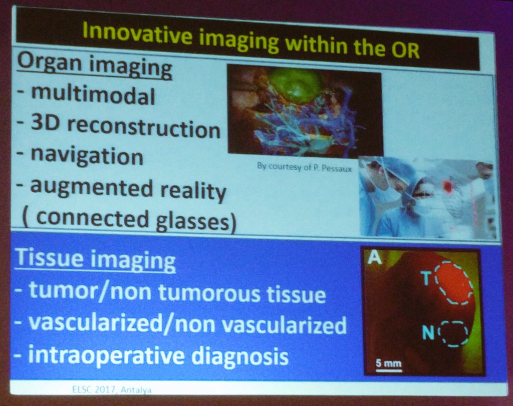 hgok's tweet photo. Dominique Franco innovative imaging in #OR #elcd2017 #laparoscopy #surgery https://t.co/qW6JkM3Vpm
