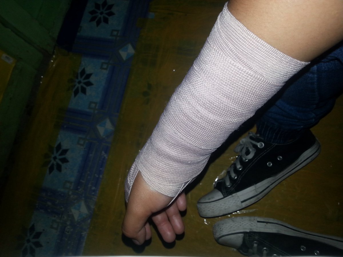 DgeeMags's tweet photo. Injured sa paglalaro ng DOTA!!??? HAHAHAHA 
JOKE 
#nahulog lang pala sa SOFA!! HAHAHA https://t.co/Ax2w1s2KN8