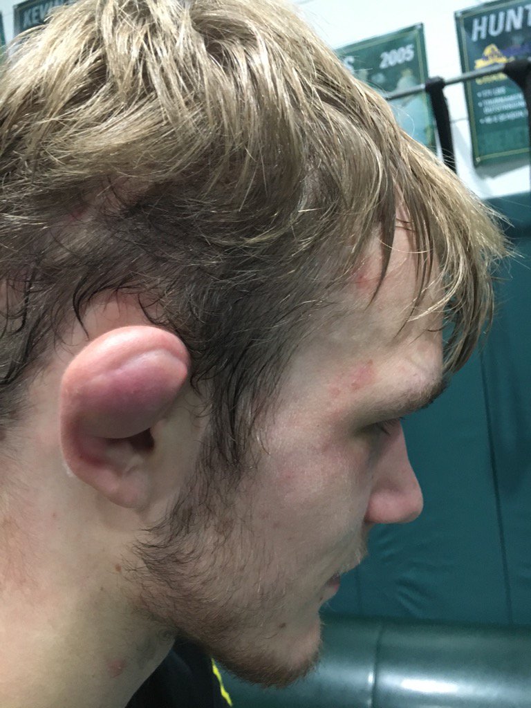 jmenwrestling's tweet photo. @jmenwrestling International Week : Cauliflower Hall of Famers https://t.co/UzUT97DL41