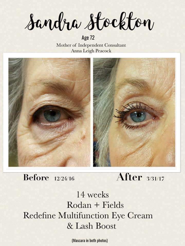 p0nxnotdead's tweet image. Whoa. 👀💣💥💖
#lashboost #multifunctioneyecream #redefine #lifechangingskincare #72yearsyoung #nosurgeryrequired #theehteam #teamgive