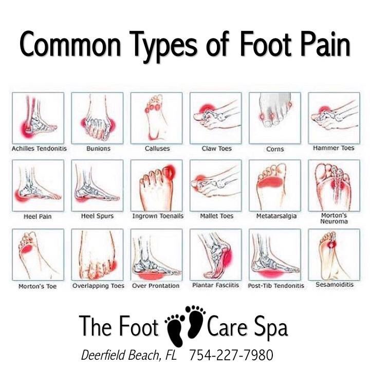 heel pain Archives - Relieve Foot Pain & Leg Pain