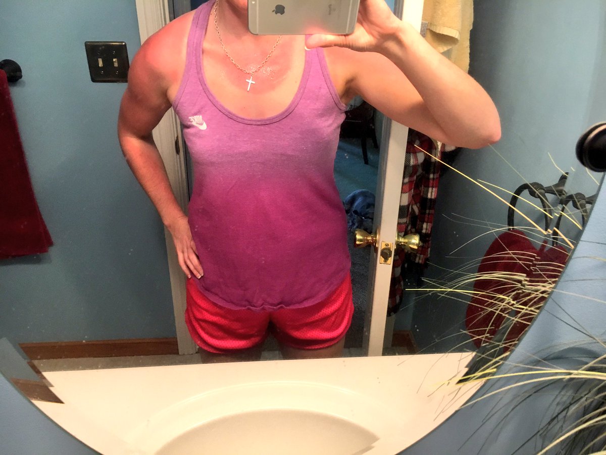 MattiB84's tweet photo. @mandyaja727_lee @K_Geezy74 please remind me to wear sunscreen next time ๐๐๐ #whitegirlgonered #burntcookie https://t.co/dEWUBEFOoA