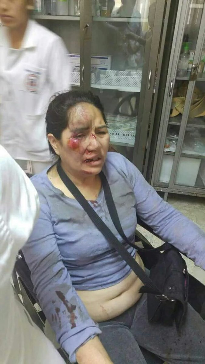 gonza_vid8's tweet photo. #BastaDeRepresion #LosDocentesNoEstanSolos https://t.co/K9BhcSsKnh