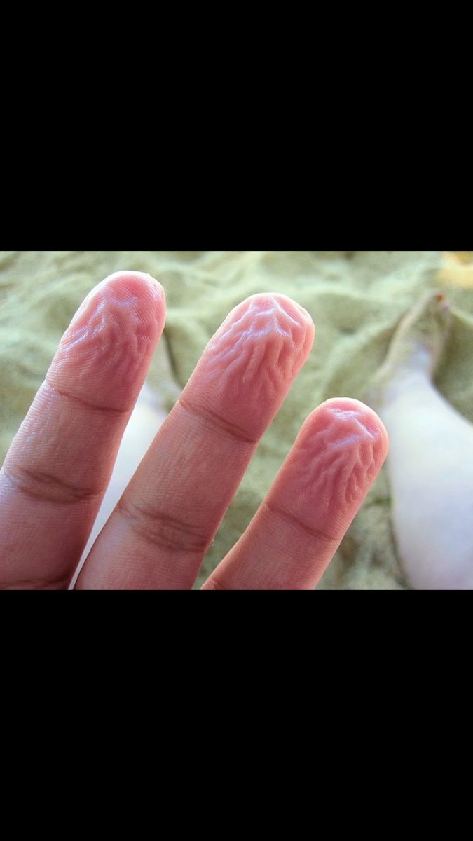 CallMeRashad's tweet image. I just found out when your fingers shrivel up like this it's your body adapting to have grip underwater
