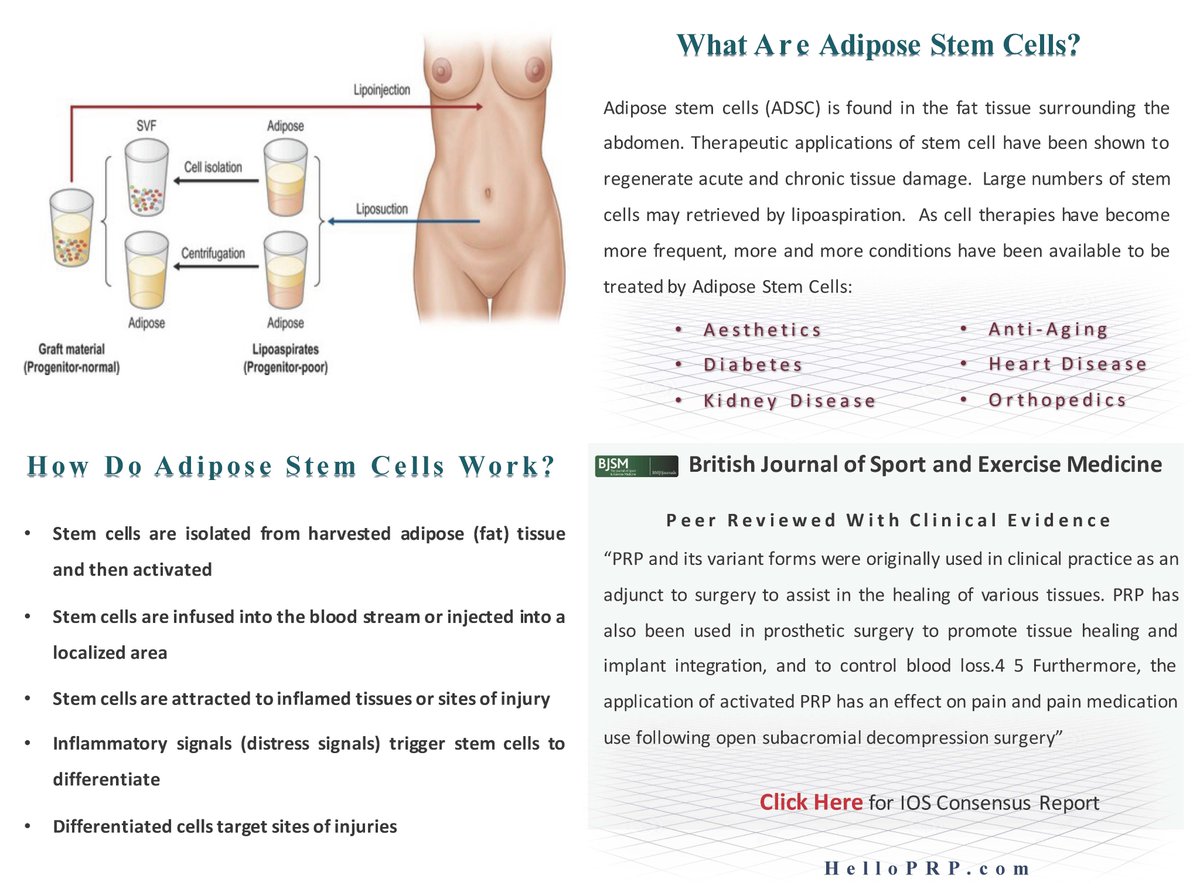 helloprp's tweet image. Hello PRP Therapy
#stemcells
Regenerate Your Body : Renew Your Life
HelloPRP.com