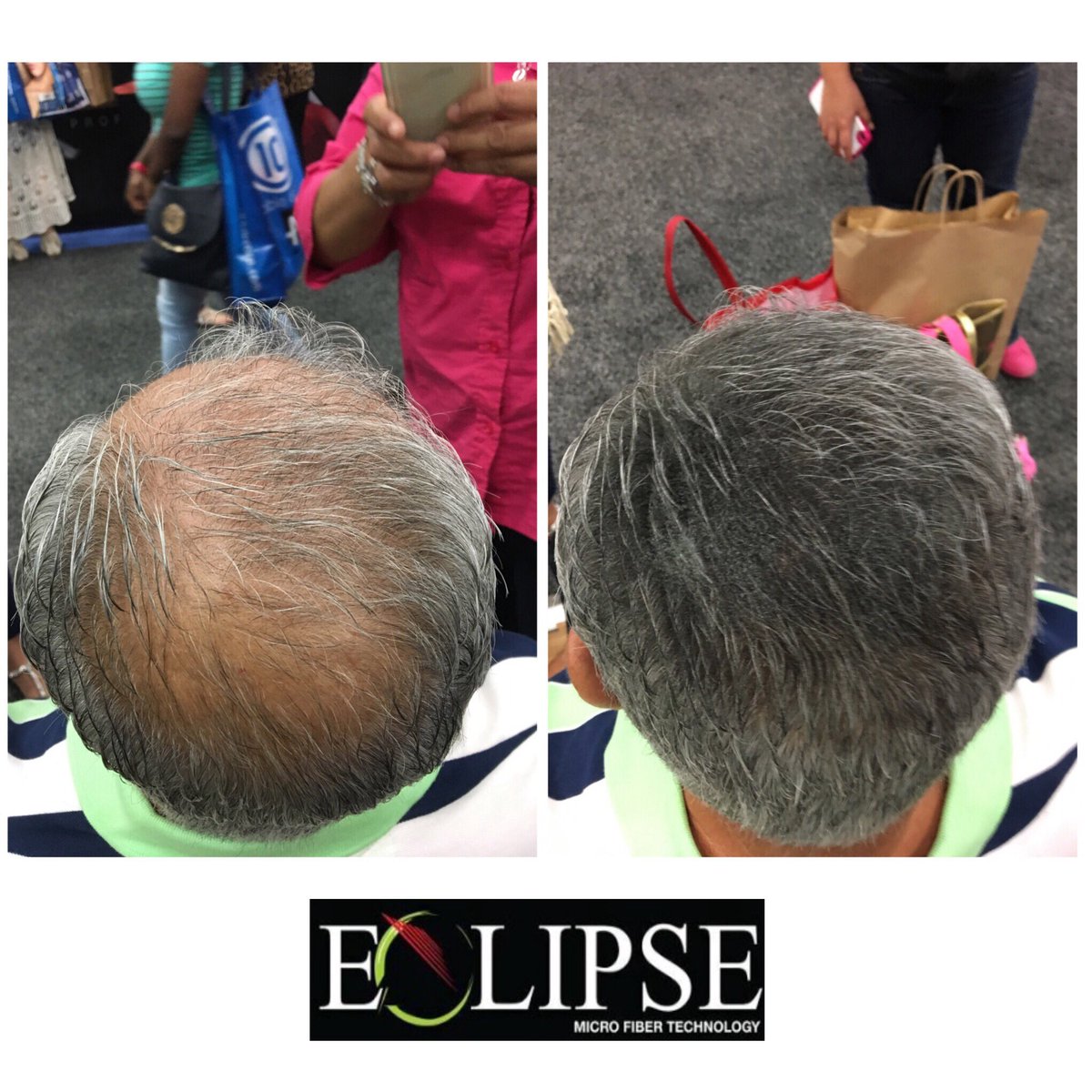 eclipsefibers's tweet photo. https://t.co/OP1yOCB99c https://t.co/UfXJuGannF
