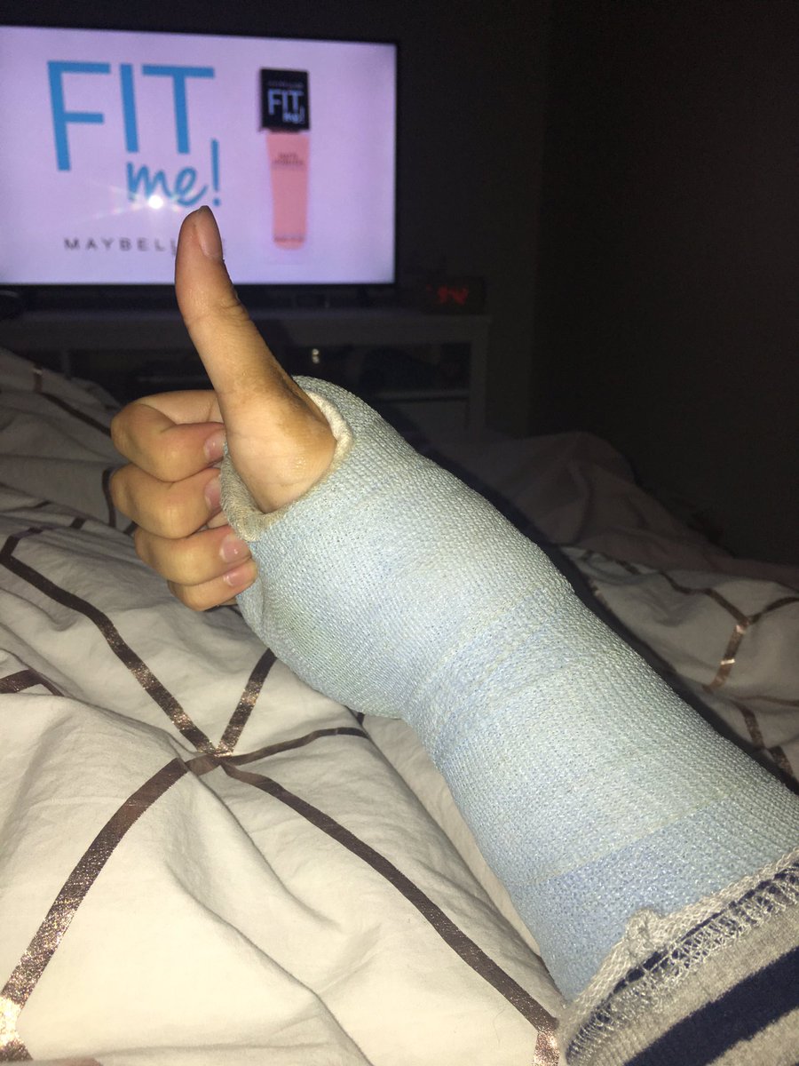 stephrogerson11's tweet photo. Get to say goodbye to this bad boy tomorrow - so glad this 6 weeks is over! Footy here I come! #goodbyecast #helloarm #hellofooty https://t.co/MCU8XHvC63
