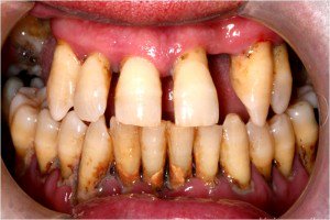 oraldentsc's tweet photo. No dejes para MAÑANA, lo que puedes hacer HOY 🙂
0243-2411463
#Maracay
#Aragua
#Turmero
#Cagua
#MBI
#quehayenmaracay
#lacooperatriva https://t.co/uxPzoOuNGP