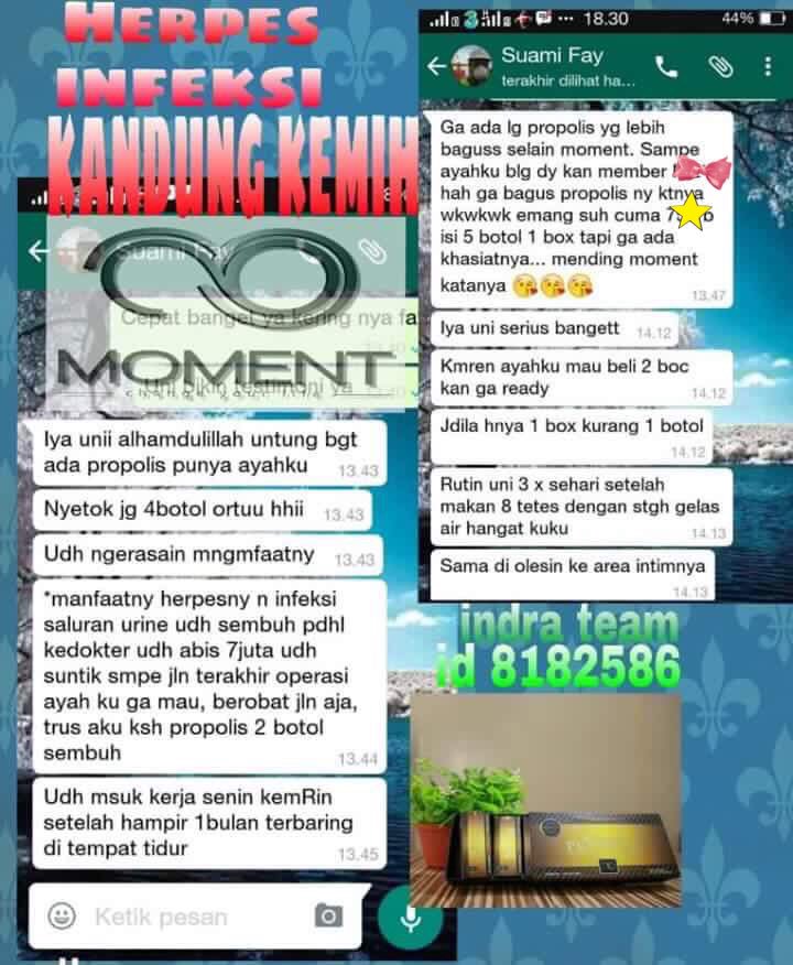anisa2eka's tweet photo. Alhamdulillah HERPES + INFEKSI KANDUNG KEMIH berangsur membaik &amp; sembuh dg therapi #Propolismoment 4btl only.
Info order WA:+6594529922 https://t.co/KbntZbINqq