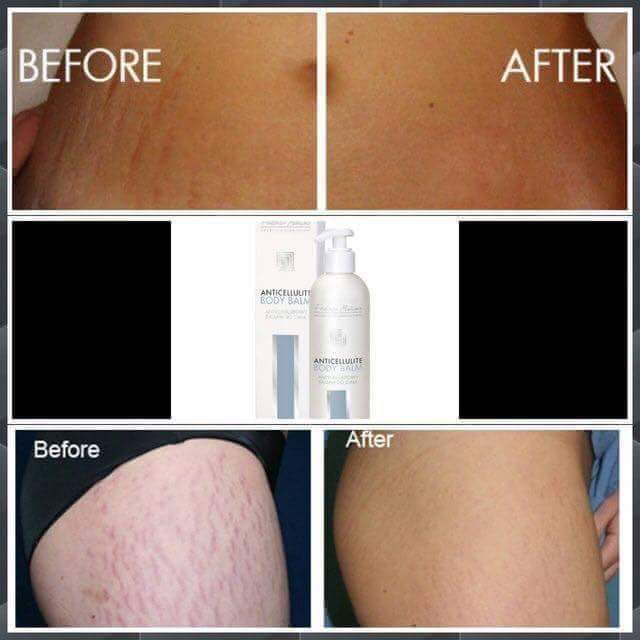 VBextensions's tweet image. Amazing Anticellulite balm for only £15! Message me for yours xx