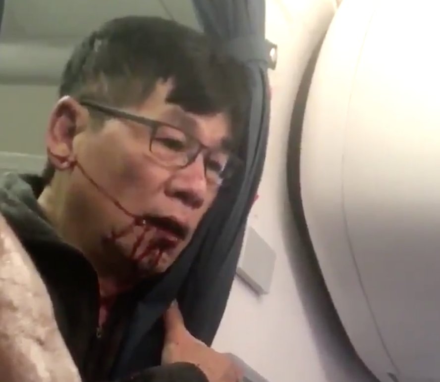 nycjim's tweet image. This is what the @United passenger looked like after he was forcibly removed from his seat. kutv.com/news/nation-wo…