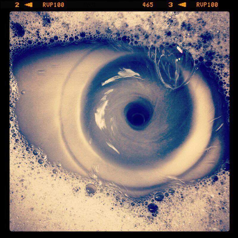 LASIKspokane's tweet photo. Dr. Edmons asks, “can you tell us what is wrong with this eye?”  Your chance to diagnose.  What do you think? 🔎👁 https://t.co/g13Dhlyqr2