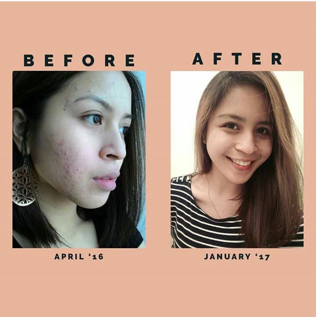 aivee clinic facial