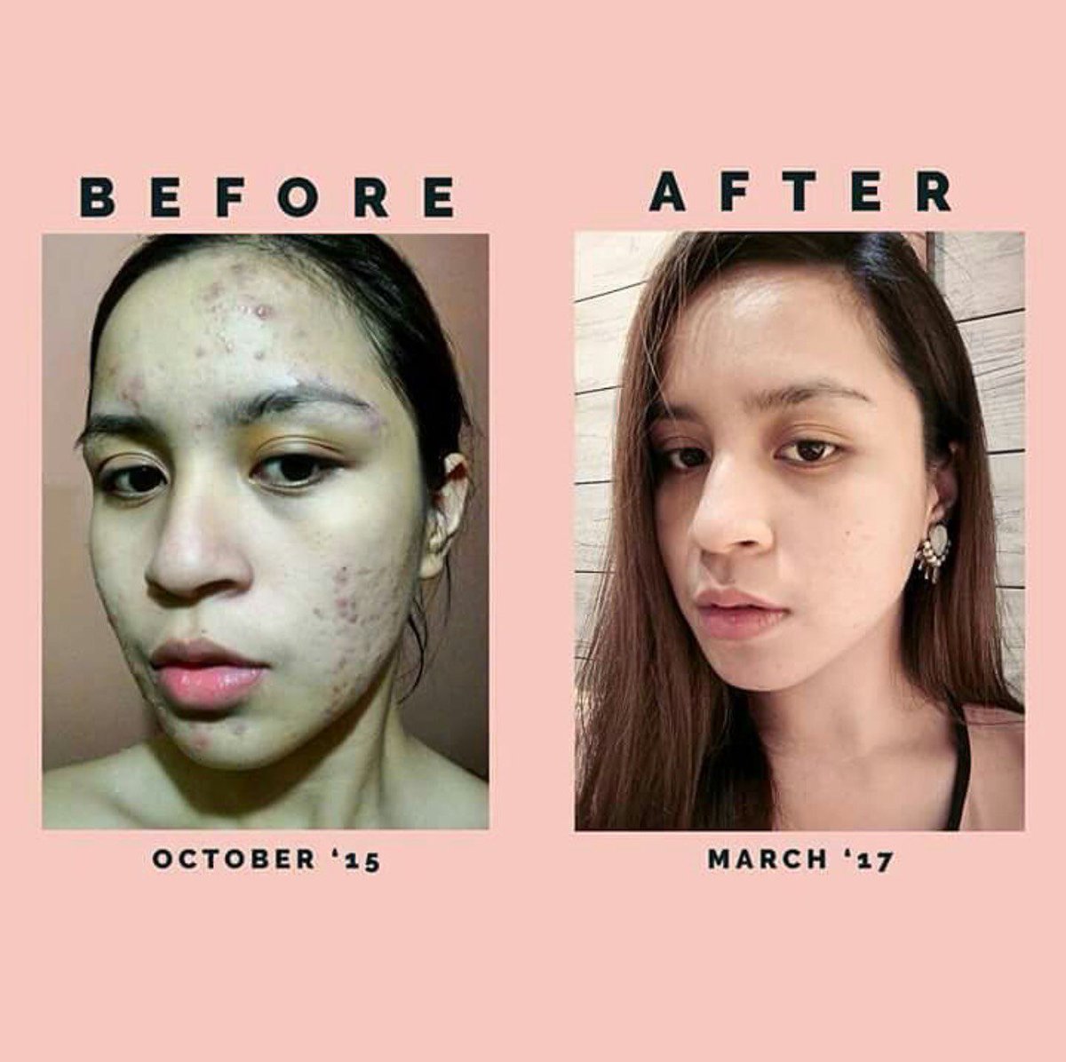 aivee clinic facial