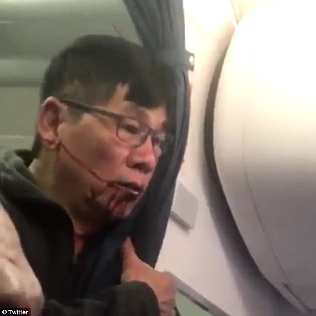 I can't even joke about this. Look at this man.  He would have stood a better chance with a mugger.  #NewUnitedAirlinesMottos