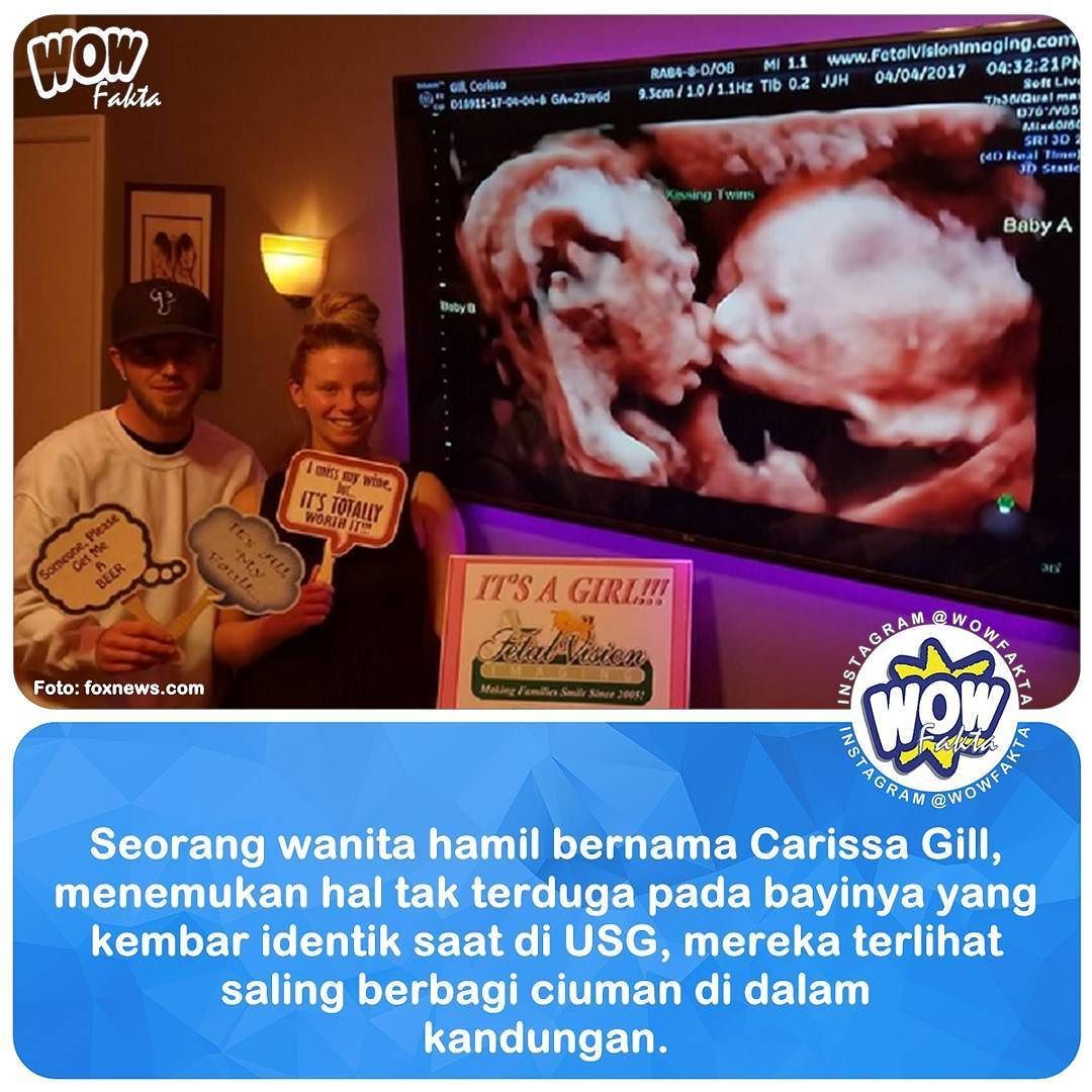 kontenwow's tweet photo. https://t.co/uBialxMIh3 [#wowfakta] Salah satu teknologi yang biasa digunakan untuk melihat perkembangan bayi dalam… https://t.co/HTR2a3rLT7