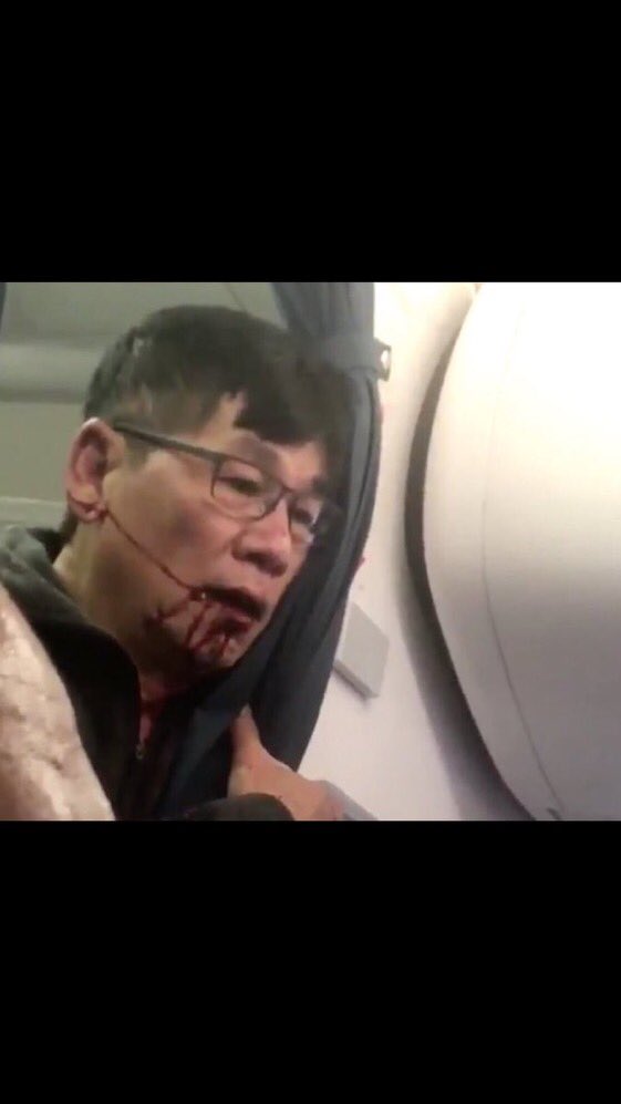 #unitedairlines You could have bought this guy his own jet for less than what you are going to pay him in his lawsuit #united #united3411