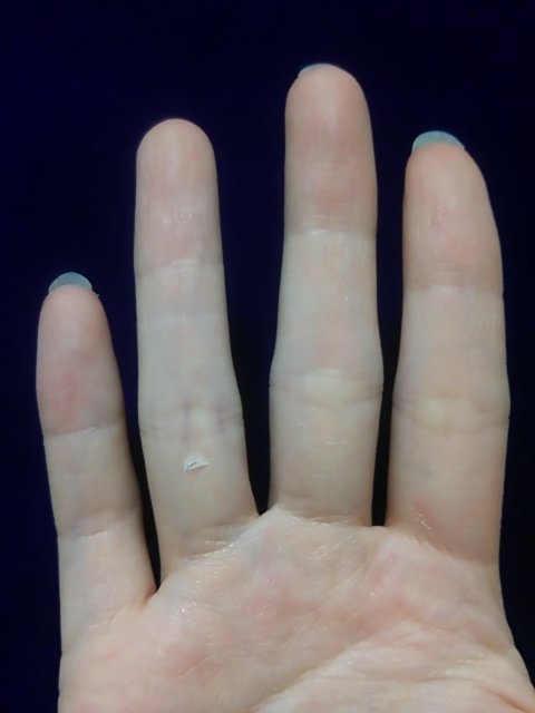 茜 お箏弾いてます 薬指の根元が 水ぶくれて皮が剥けた あっ 人差し指も 思い当たるのは三弦の撥 ぎゅっと握りしめちゃうんだよね 三弦の基礎って難しい